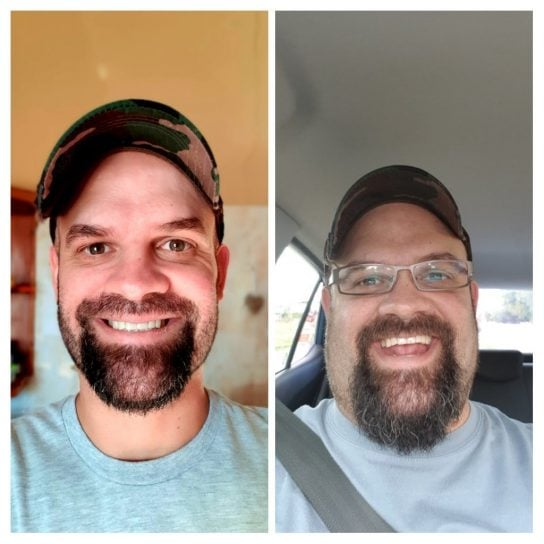 Keto Diet & Intermittent Fasting South Africa Before and After
