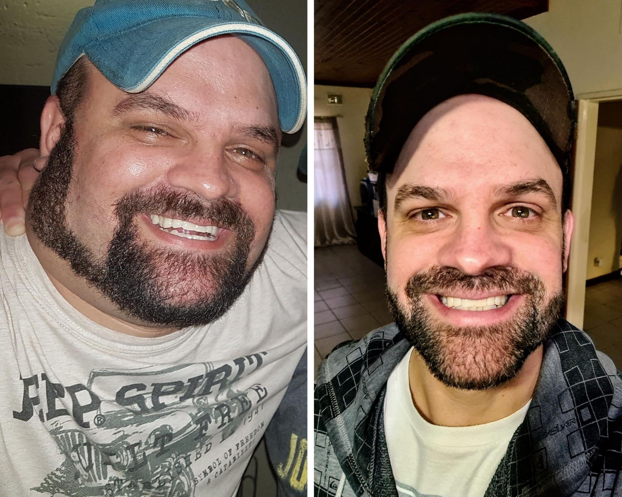 keto before and after
